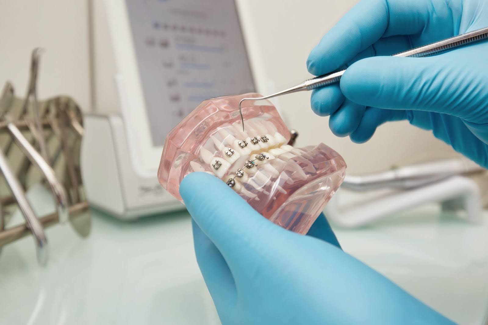 Orthodontics and tooth misalignment treatment at Community Smiles Elizabeth & Hillside